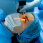 private cataract surgery London